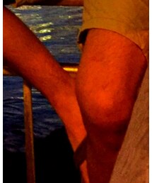 Hollister | サンダル