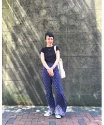 前髪はげる | その他