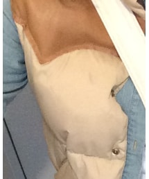 Rocky Mountain FeatherBed | ダウンベスト