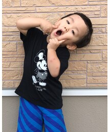 この時期に蚊に刺されまくれてる😅 | トップス