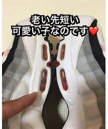 余命あと4、5年かな😢 | 黄色くなってる部分が加水分解(スニーカー)