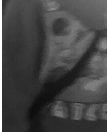 BlackEyePatch | パーカー