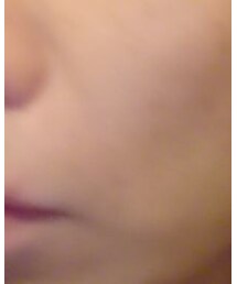 ケアに手を出してもうた、無駄遣い③ | 仕事終わりに魔が差した美容鍼(その他)