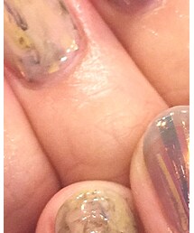 ☆ | リング