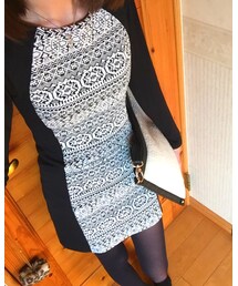 H&M | ワンピース/ドレス