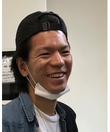おでこのテカり | その他