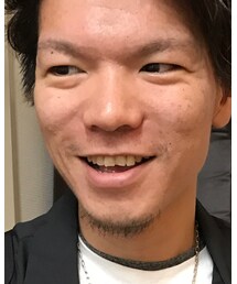 アクセ増えてご満悦 | その他