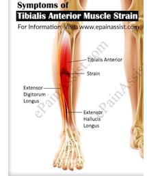 🏀前脛骨筋挫傷 | レッグウェア