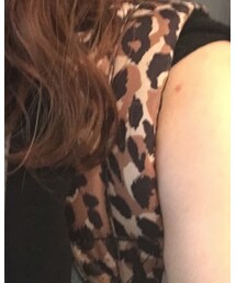 HERSHEL | バックパック/リュック