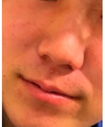 Supreme  | トップス