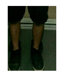 KRIS VAN ASSCHE | スニーカー