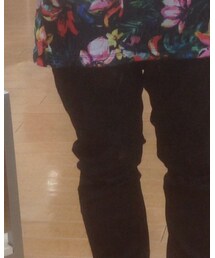 H&M | デニムパンツ