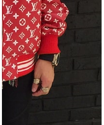 HUBLOT | アナログ腕時計