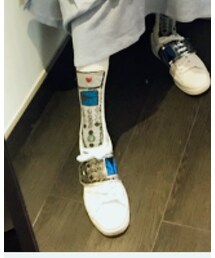 TSUMORI CHISATO | スニーカー