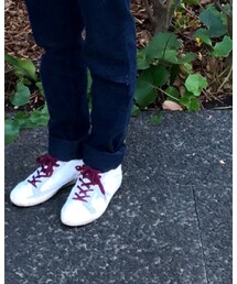 GOLDEN GOOSE | スニーカー