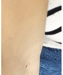 earth music&ecology | トレンチコート