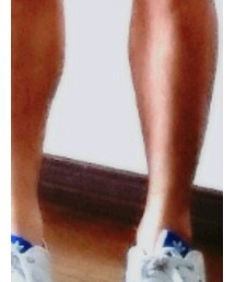 adidas | スニーカー