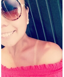 BBQで日焼け | その他