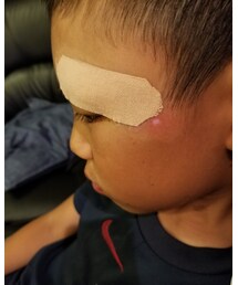 縫いました( ̄□ ̄;)!! | その他