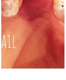 ジェルネイル | その他