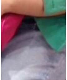 Abercrombie&Fitch | デニムパンツ