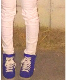 DIESEL | スニーカー