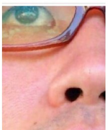 SPIVVY金子眼鏡 | 実用からここへ。度入りレンズが曇ってた、って。(メガネ)