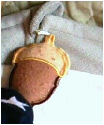 どんぐり | その他