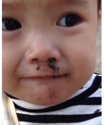 公園の砂 | その他