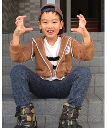 両方？パイナッポー | その他