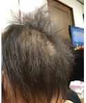 ハゲあがっとるやないかいの「帽子(サンバイザー)」