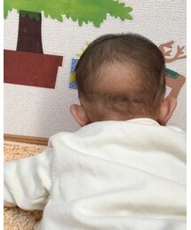 後頭部 | その他
