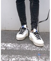 GOLDEN GOOSE | スニーカー