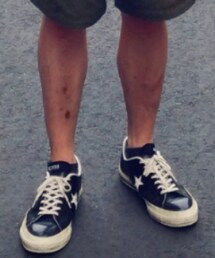 CONVERSE | スニーカー