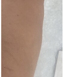 すり傷 ヒリヒリ | ブレスレット