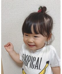 左側ハゲてるやん😱 | その他