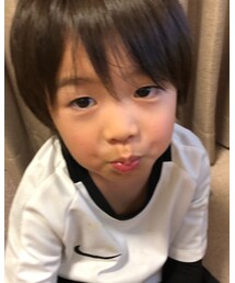 りんご病🍎なったっぽい | その他