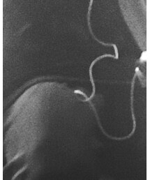 ZARA | ニット/セーター