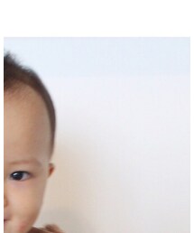 絶賛薄毛中だけどヘアピンなら大丈夫だった😂 | その他