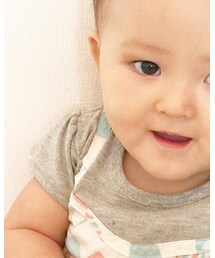 週末誕生日撮影あるのに右瞼強打で青タン😂ビジュアルバンドみたいw | その他