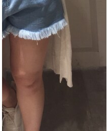 adidas | スニーカー