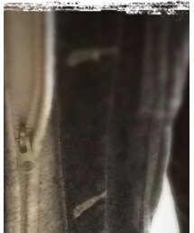 FOREVER 21 | ジャケット/アウター