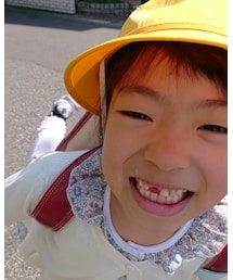 歯が抜けました😁 | その他