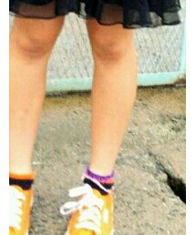 SUPERGA | スニーカー