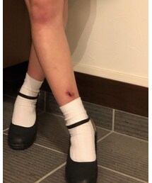 かさぶた | アンクレット