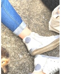 GOLDEN GOOSE | スニーカー