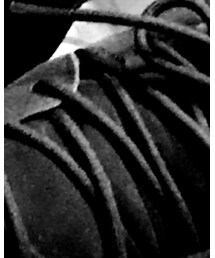 adidas | スニーカー