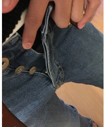 H&M | チャックの部分がボタンのスキニーデニムです。(デニムパンツ)