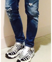 DIESEL | サンダル