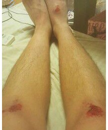 男の金メダル | その他